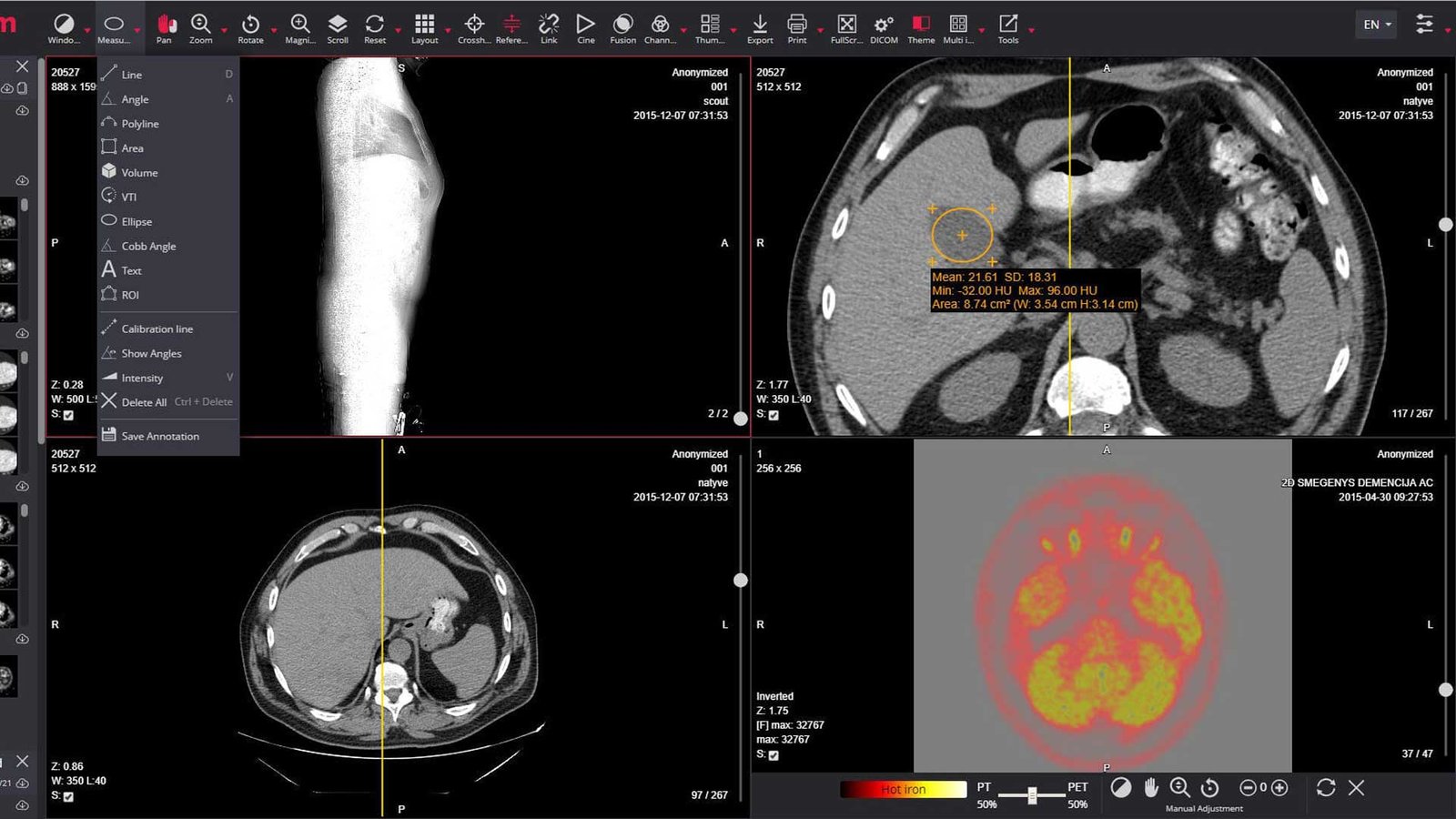 Why DICOM PACS Software Is the Best for Medical Imaging