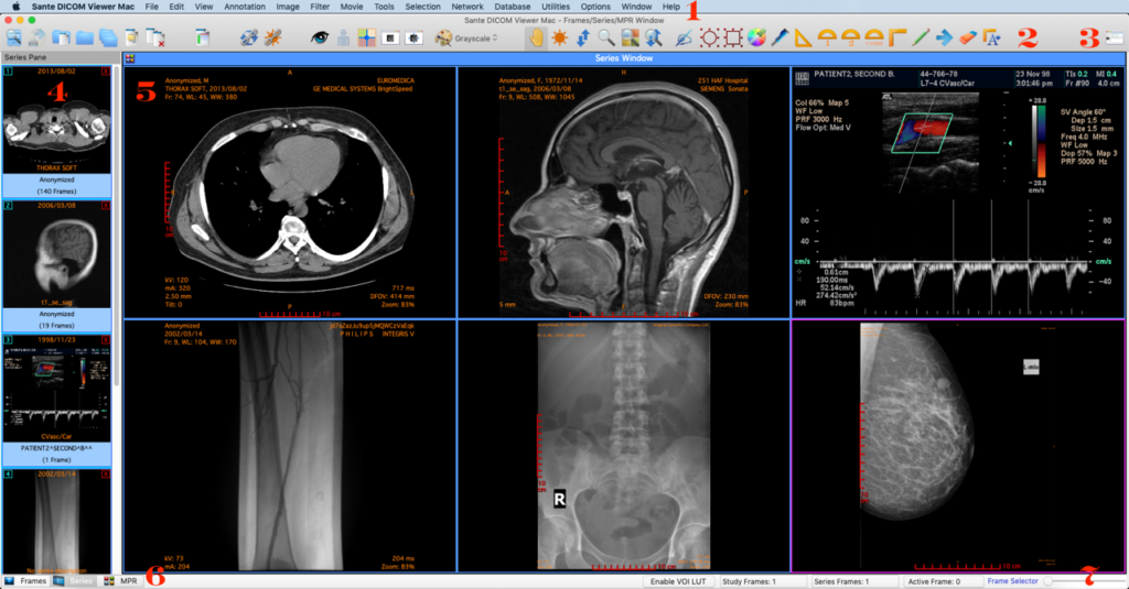 DICOM viewer free