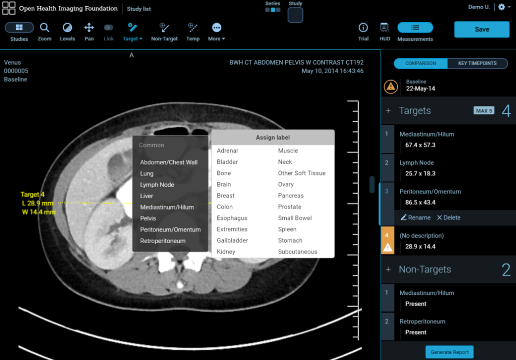 DICOM viewer free