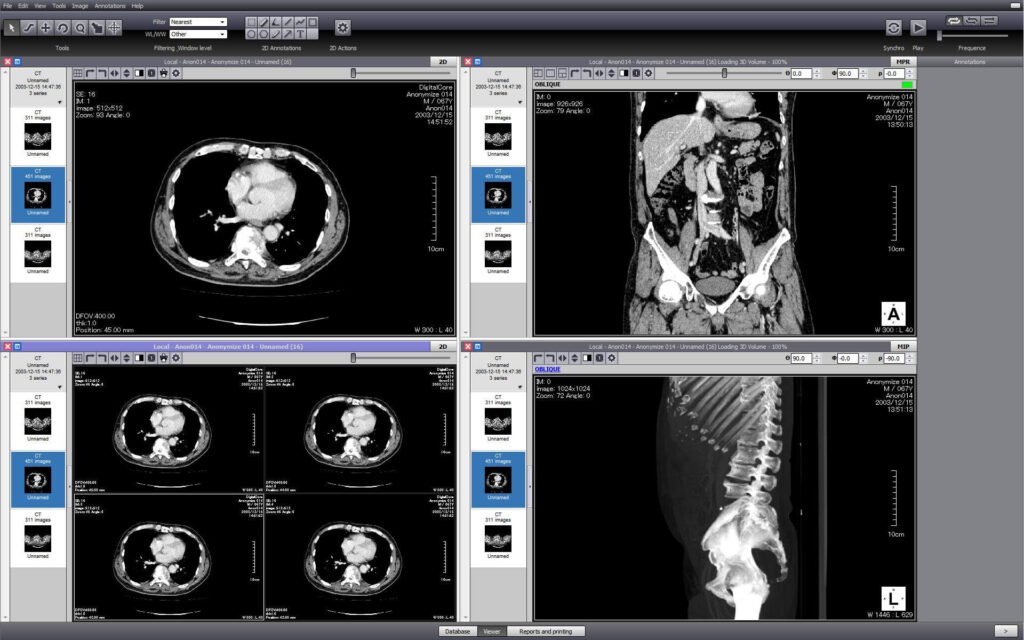 free online DICOM viewer