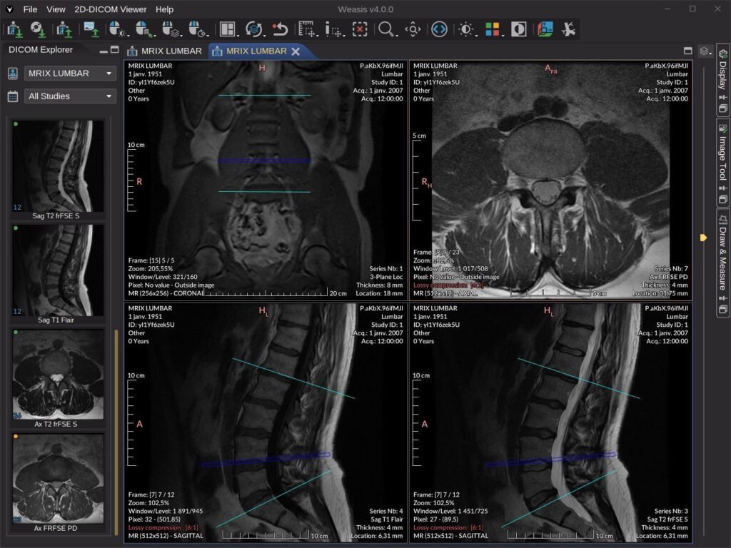 DICOM medical image viewer
